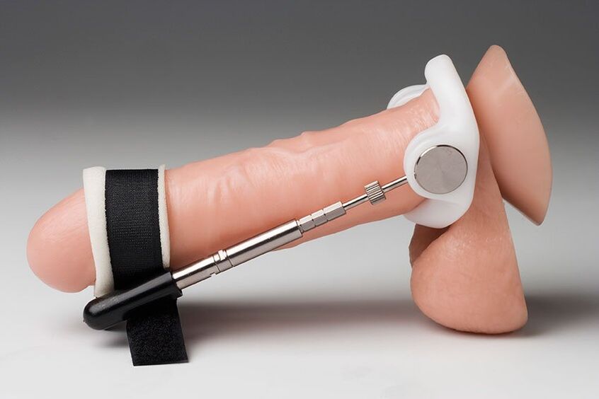 Muy a menudo, se utilizan un extensor y bombas de vacío para agrandar la cabeza.